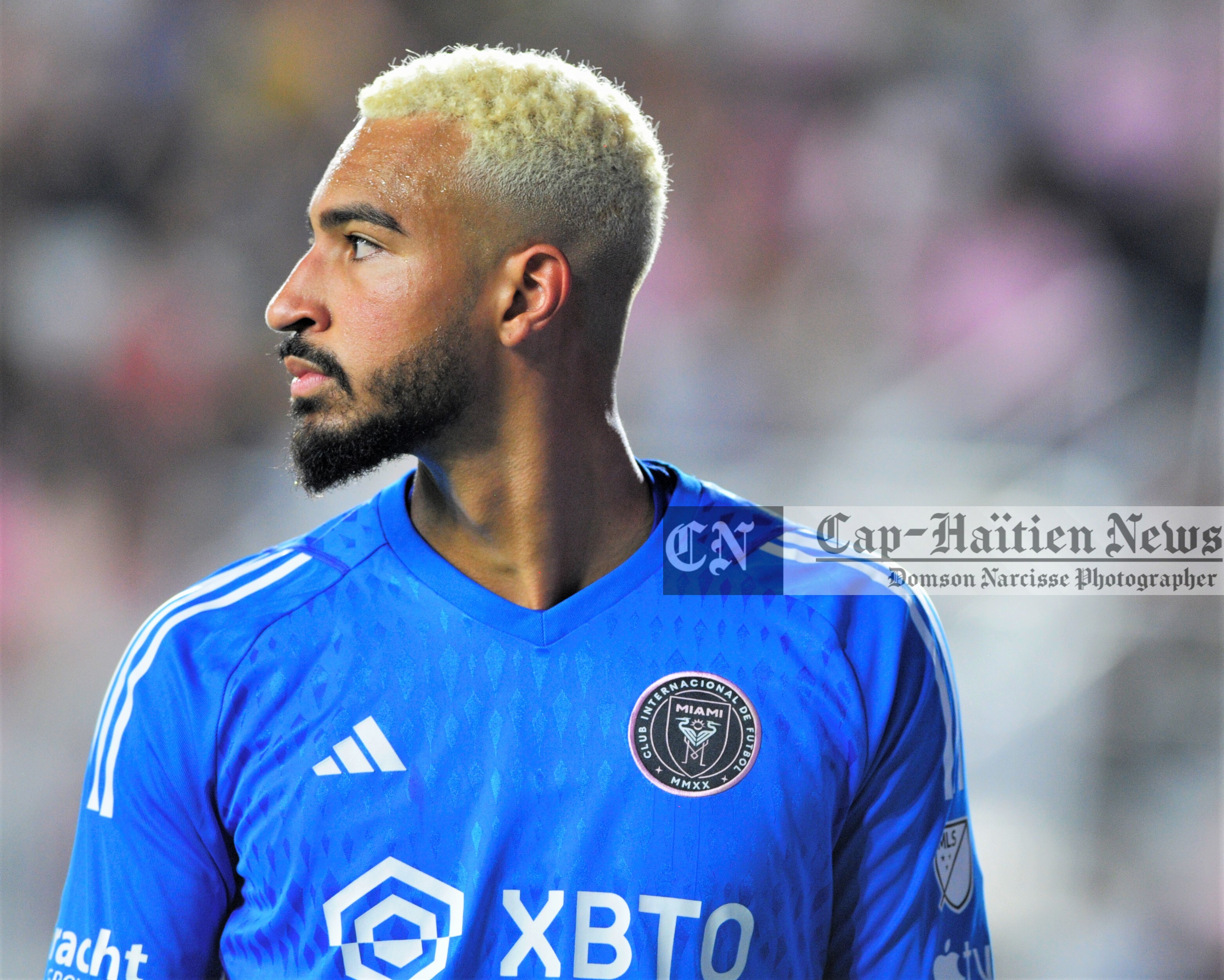 MLS-Football- La nouvelle couleur de cheveux de Gardien de but Drake Steven Callender