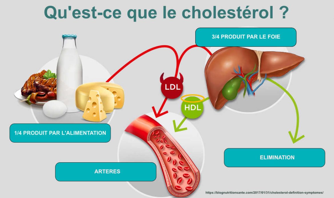 Cholestérol : ces signes sur vos jambes n’annoncent rien de bon pour votre santé